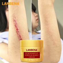 LANBENA-Crema para eliminar cicatrices y acné, tratamiento para acné, puntos negros, reduce los poros, estrías, blanqueamiento, cuidado de la piel, 40g 2024 - compra barato