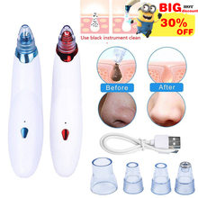 Diamond Dermabrasion Blackhead Vacuum Cleaner Suction Removal Scar Acne Pore Peeling Face Clean Facial Skin Care Cupping 2024 - buy cheap