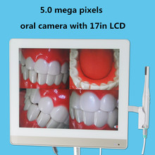 Monitor LCD de 5,0 megapíxeles, endoscopio Dental con usb, cámara intra oral, todo en una máquina, 17 pulgadas, novedad 2024 - compra barato