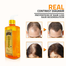 300 ml Chinese Medicines Professional Ginger Hair Growth Shampoo Against Hair Loss Anti Dandruff Hair Care Black Hair Shampoo 2024 - buy cheap