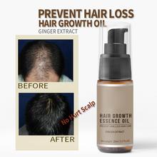 Эссенция для быстрого и мощного роста волос, 20 мл, продукты для выпадения волос, эфирное масло, жидкость для лечения, предотвращение выпадения волос, продукты для ухода за волосами 2024 - купить недорого