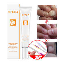 2PC EFERO Fungus Nail Treatment Cream Onychomycosis Paronychia Nail Care Anti Fungal Nail Infection Remedy for Nail Fungus Cream 2024 - buy cheap