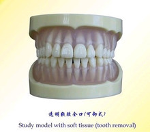 Modelo odontológico oral transparente removível frete grátis 2024 - compre barato