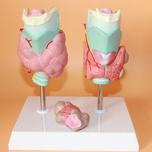 Thyroid pathology model Thyroid tumor Throat Thyroid anatomy model 2024 - buy cheap