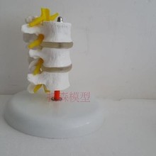 Lumbar Model Teaching joint skeleton model free shipping 2024 - buy cheap