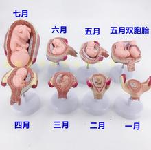 Modelo de desarrollo del embarazo, modelo de planificación de la familia, modelo de visualización de la planificación del nacimiento, modelo fetal de útero 2024 - compra barato
