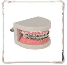 Adult Orthodontic teeth model/Dental Orthodontic tooth model with bracket/Dental Lab Teeth model 2024 - buy cheap