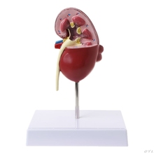 Kidney Diseased Model Anatomical Anatomy Diseased Pathological Stone Organ Teaching Supplies L29K 2024 - buy cheap