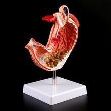 Human Anatomical Anatomy Stomach Medical Model Gastric Pathology Gastritis Ulcer Medical Teaching Learning Tool 2024 - buy cheap