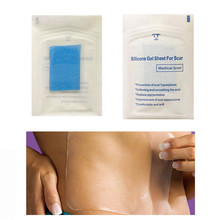 Remendo removedor de silicone auto-adesivo, 3.5*5cm reutilizável terapia de acne gel cicatriz remendo, removedor de queimaduras de trauma folha de reparo da pele 2024 - compre barato