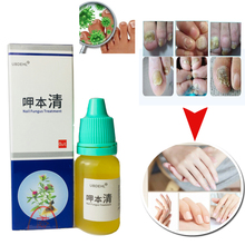 Лечение ногтей онихомикоз паронихия противогрибковая инфекция ногтей хороший результат Китайский травяной ногтевой грибок лечение 2024 - купить недорого