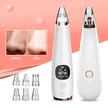 Clean Blackhead Vacuum Suction Remove Machine Electric Blackhead Remover Skin Care Device Face Pore Acne Pimple Removal 2024 - buy cheap