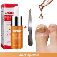 LANBENA-Tratamiento de hongos en las uñas, aceite esencial para cutículas, 15ml, para reparación de uñas, eliminación de hongos en los dedos del pie, onicomicosis, cuidado de las uñas 2024 - compra barato