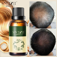Эссенция для ухода за волосами, 30 мл, жидкая сыворотка для восстановления корней волос TSLM2 для быстрого роста и предотвращения выпадения волос 2024 - купить недорого