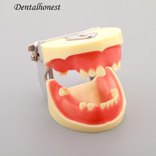 Modelo de prática de implante dentário modelos de dentes m2002 2024 - compre barato