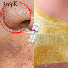 OEDO Gold Remove Blackhead Mask Shrink Pore Improve Rough Skin Acne Shills Blackhead Remover Mask Facial Moisturizing Cream 2024 - buy cheap
