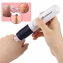 Electric Blackhead Remover Tool Face Nose Acne Pimple Wart Remover Vacuum Suction Black Spots Pore Cleaner Suck Up Blemish 2024 - buy cheap