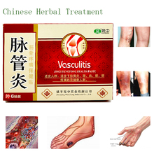 Yeso Natural para el tratamiento de las venas varicosas, herbal de estilo chino para curar las venas de araña, 21 Uds. 2024 - compra barato