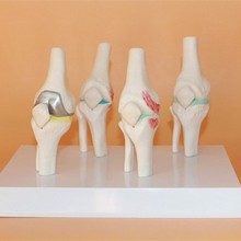 Knee Disease model Orthopedics teaching Medical teaching model free shipping 2024 - buy cheap
