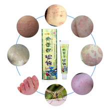 LIUYAOSHI Herbal Antifungal Skin Cream Treatment Psoriasis Dermatitis And Eczema Pruritus Used For Repair Skin Allergic Problems 2024 - buy cheap