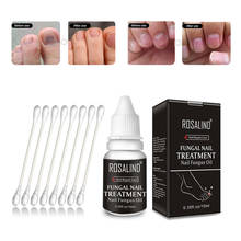 Лечение онихомикоза грибковым маслом для ногтей ROSALIND для восстановления лака для ногтей решение проблем с ногтями питательное решение для увеличения блеска 2024 - купить недорого