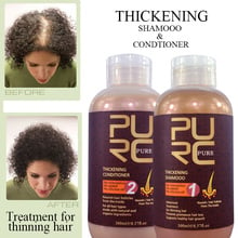 Best Effect Hair Shampoo And Conditioner For Hair Growth And Hair Loss Prevents Premature Thinning Hair For Men And Women 2024 - buy cheap
