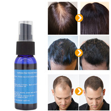 Y&W&F Fast Growth 30ml Yuda Pilatory Spray Anti Baldness Hair Care Hair Loss Treatment Beard Oil Growing Facial Hair TSLM2 2024 - buy cheap