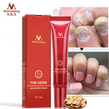 Хит продаж, крем для ухода за ногтями MeiyanQiong, травяной крем для восстановления ногтей, против грибков, китайский травяной крем для ногтей, Лечение грибка 2024 - купить недорого