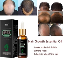 Hair Growth Essential Oils Anti Hair Loss Liquid Dense Hair Growth Serum Essence Hair Care 2024 - buy cheap