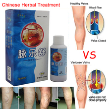 3pieces per lot Vasculitis Spray Varicose Veins Treatment Spray On Leg Acid Bilges Itching Earthworm Lumps Bad Leg Cure Natural 2024 - buy cheap