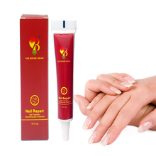 Gesso em creme de tratamento de unhas, medicina chinesa, onicomicose, anti-infecção de unhas, luta contra bactérias, pomada natural 2024 - compre barato