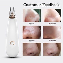 Vip dropshipping removedor de cravo aspirador de poros nariz elétrico rosto limpeza profunda cuidados com a pele máquina ferramenta preto dot acne 5 2024 - compre barato