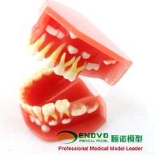 Dental dentistry model of pediatric dentition 2024 - buy cheap