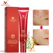 High Quality Herbal Cleansing Gel Face Anti acne treatment cream Herbal scar removal oily skin Acne Spots skin care face 2024 - buy cheap