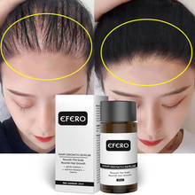 EFERO 20 мл Сыворотка для роста волос предотвращает выпадение волос эссенция эфирное масло питает сыворотку для роста волос более плотная забота о здоровье 2024 - купить недорого