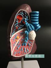 human model Lung anatomy model of human lesions visceral  pvc 2/3 life-size free shipping 2024 - buy cheap