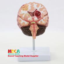 MDN008, Обучение модели мозга, медицина для пациентов с взрослыми, с человеческой патологией, мозгом, сердечно-сосудистыми операциями и операциями на сосудах мозга 2024 - купить недорого