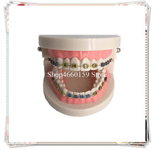 Modelo dental do dente ortodôntico com suporte e laço elástico/clínica dental usar o modelo dos dentes 2024 - compre barato
