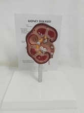 Renal anatomy teaching aids Model of medical instrument Renal pathological Health dissection model free shipping 2024 - buy cheap