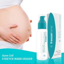 Australia Freezeframe Stem Cell Treatment for Stubborn Old New STRETCH MARK ERASER Damaged Skin Improve Elasticity Smooth Skin 2024 - buy cheap