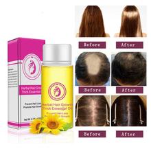 20mL Powerful Hair Growth Care Essence oil 20ml Treatment  Anti-Hair Loss products Faster Grow Thick Hairs 2024 - buy cheap