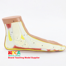 Flat foot, flat foot arch collapse model joint anatomy model medical teaching MJRJ003 2024 - buy cheap