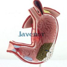 New1:1 Life size Human Anatomical Stomach Gastric Diseases Anatomy Medical Model 2024 - buy cheap