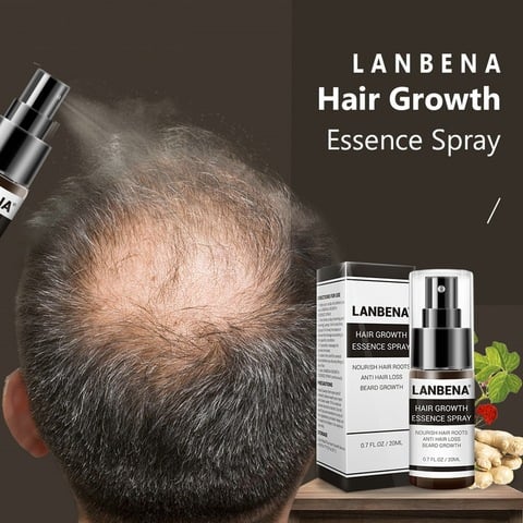 LANBENA переносной Уход за волосами эссенция для роста волос спрей против выпадения волос Предотвращение облысения укрепление питает женщин и мужчин 2022 - купить недорого
