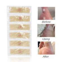 36Pcs/Box Foot Corn Removal Plaster Feet Callus Remove Soften Skin Cutin Sticker Cure Toe Protector with Hole Warts Thorn Patch 2024 - buy cheap