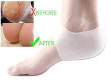 Silicone Gel Heel Protector Sleeve for Cracking Heel moisturize SPA Socks for Man Shoes Woman Feet Care Insoles 2024 - buy cheap