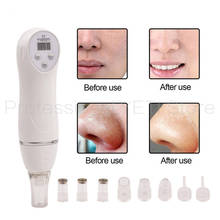6 Tip Facial Care Beauty Device Skin Diamond Dermabrasion Removal Scar Acne Pore Peeling Machine Care Massager Microdermabrasion 2024 - buy cheap