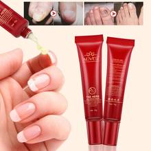 Natural Nail Repair Cream For Finger And Toe Skin Care Fungus Treatment Herb Nail Care Tool Protector 2024 - buy cheap