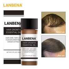 LANBENA Fast Powerful Hair Growth Essence Products Essential Oil Liquid Treatment Preventing Hair Loss Hair Care Andrea 20ml 2024 - buy cheap
