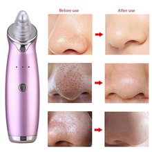 Blackhead Remover Pore Vacuum Cleaner Black Dot Acne Pimple Removal Vacuum Suction Facial Dermabrasion Machine Face Beauty Tool 2024 - buy cheap